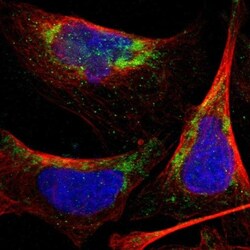 PNKD Antibody, Novus Biologicals:Antibodies:Primary Antibodies